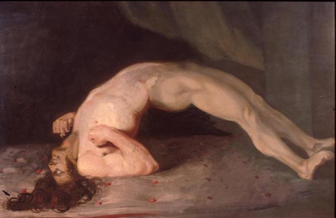 https://upload.wikimedia.org/wikipedia/commons/d/d8/Opisthotonus_in_a_patient_suffering_from_tetanus_-_Painting_by_Sir_Charles_Bell_-_1809.jpg