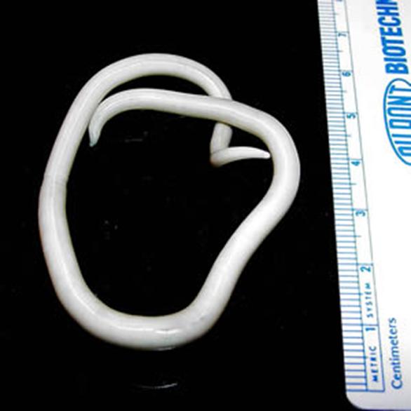 File:Ascaris lumbricoides.jpeg